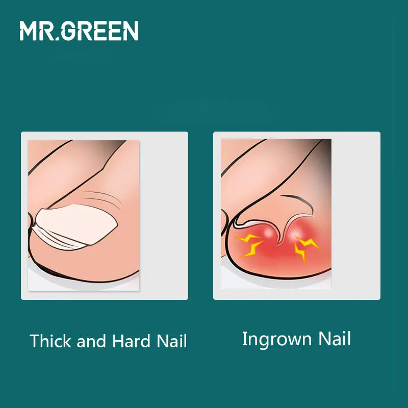 MR.GREEN Manicure Tools Professional Stainless Steel Thick Toenails Ingrown Cuticle Nipper  Trimmer Plier Scissors Nail Clippers