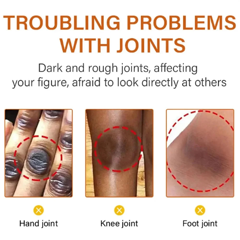 Body Whitening Cream Arms Thighs Underarm Knees Whitening Essence Cream Brighten Moisturizing Body Korean Skin Care Products New