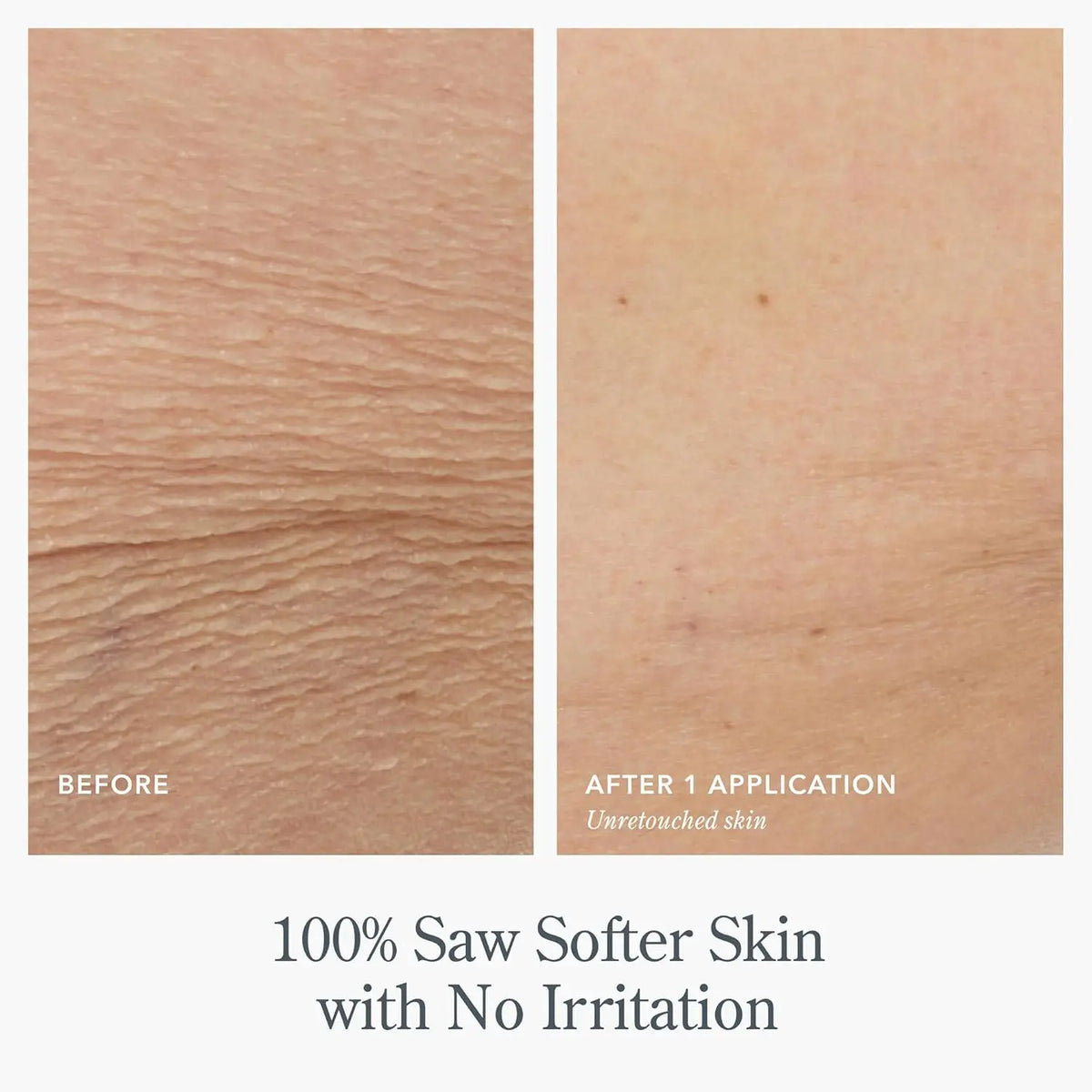 Japanese Whitening Cream 500ml Private Parts Underarm Butt Knee Brighten Inner Thigh Intimate Area Dark Remove Melanin Lighten
