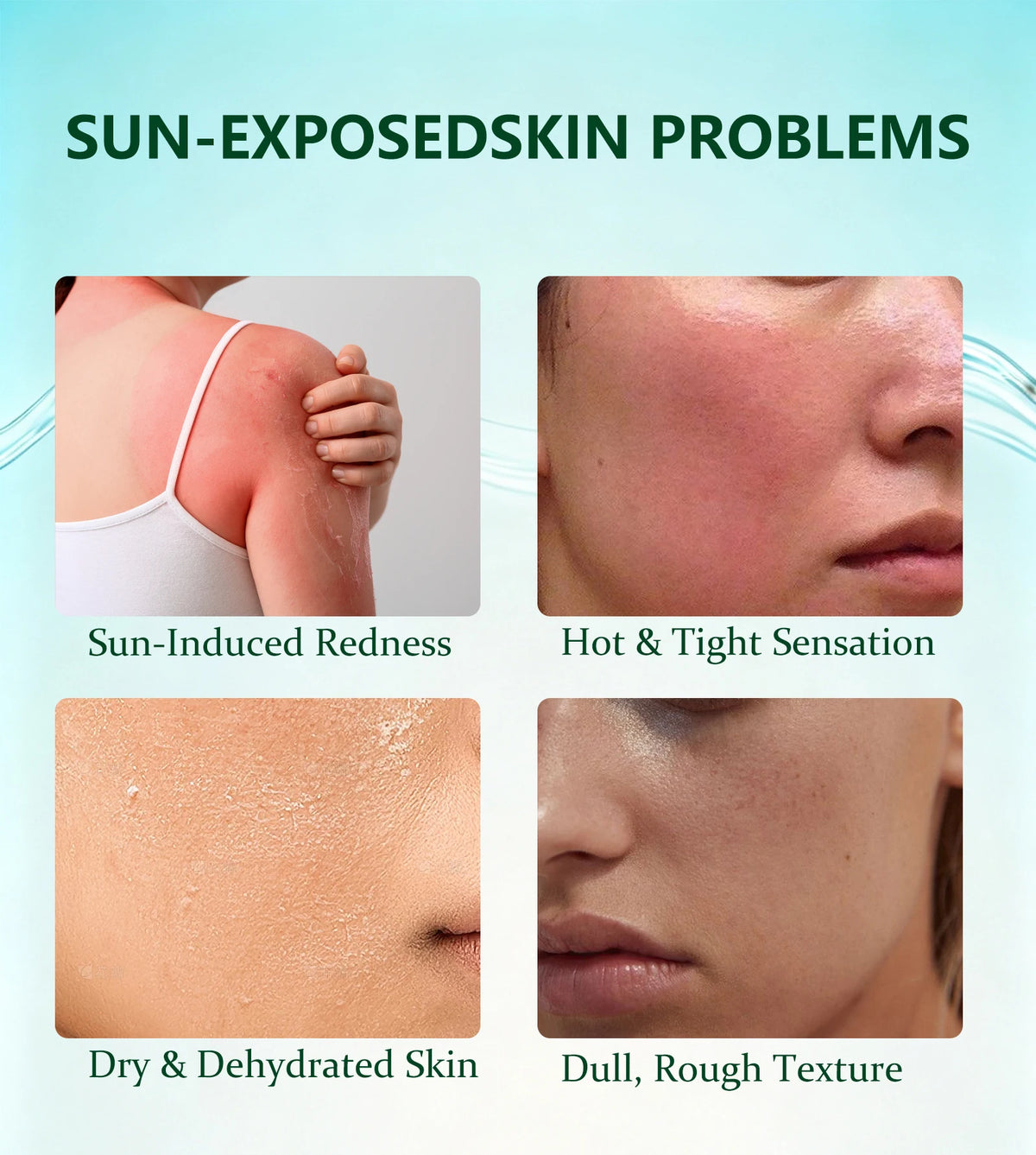 Soothing After Sun Gel，Daily Soothing Gel with Aloe Vera for Face and Body, Refreshing After-Sun Care