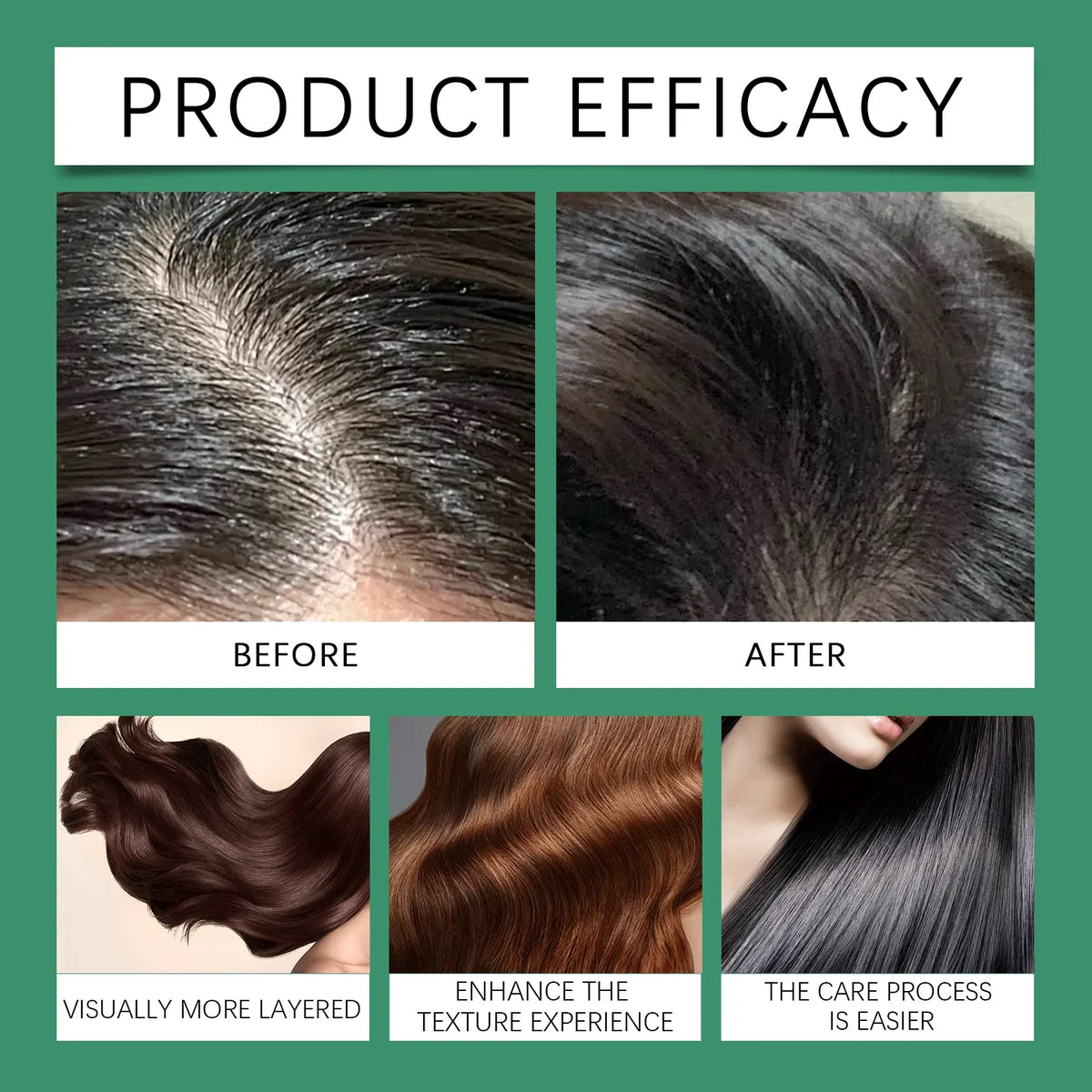 7 Days Fast Ginger Hair Growth Serum Prevent Hair Loss Scalp Treatment Thicker Longer Hair for Accelerate Growth