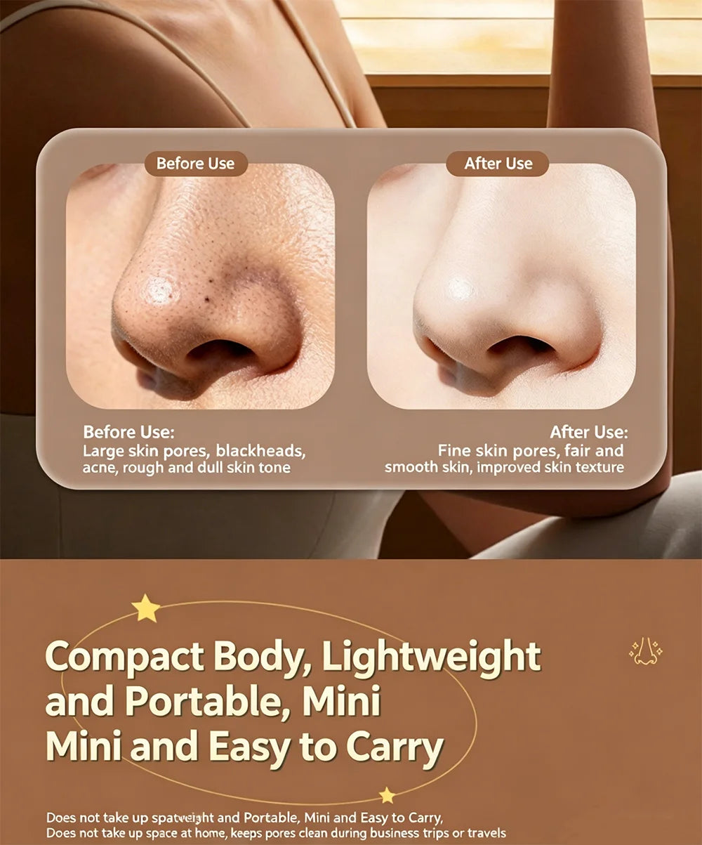 Blackhead Suction Device Electric Suction Beauty Salon Men's Specific Blackhead Suction Device