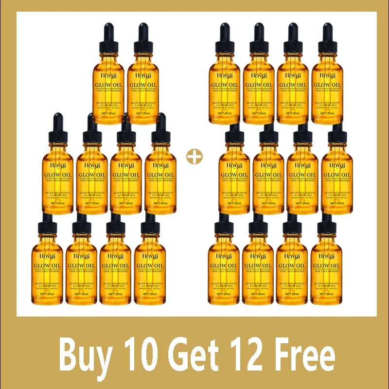Facial Oil Anti Aging Face Treatment Hydrating Moisturizer Wrinkle Reducer for Dry Skin Rosehip Oil Brightening 30ml Non Greasy