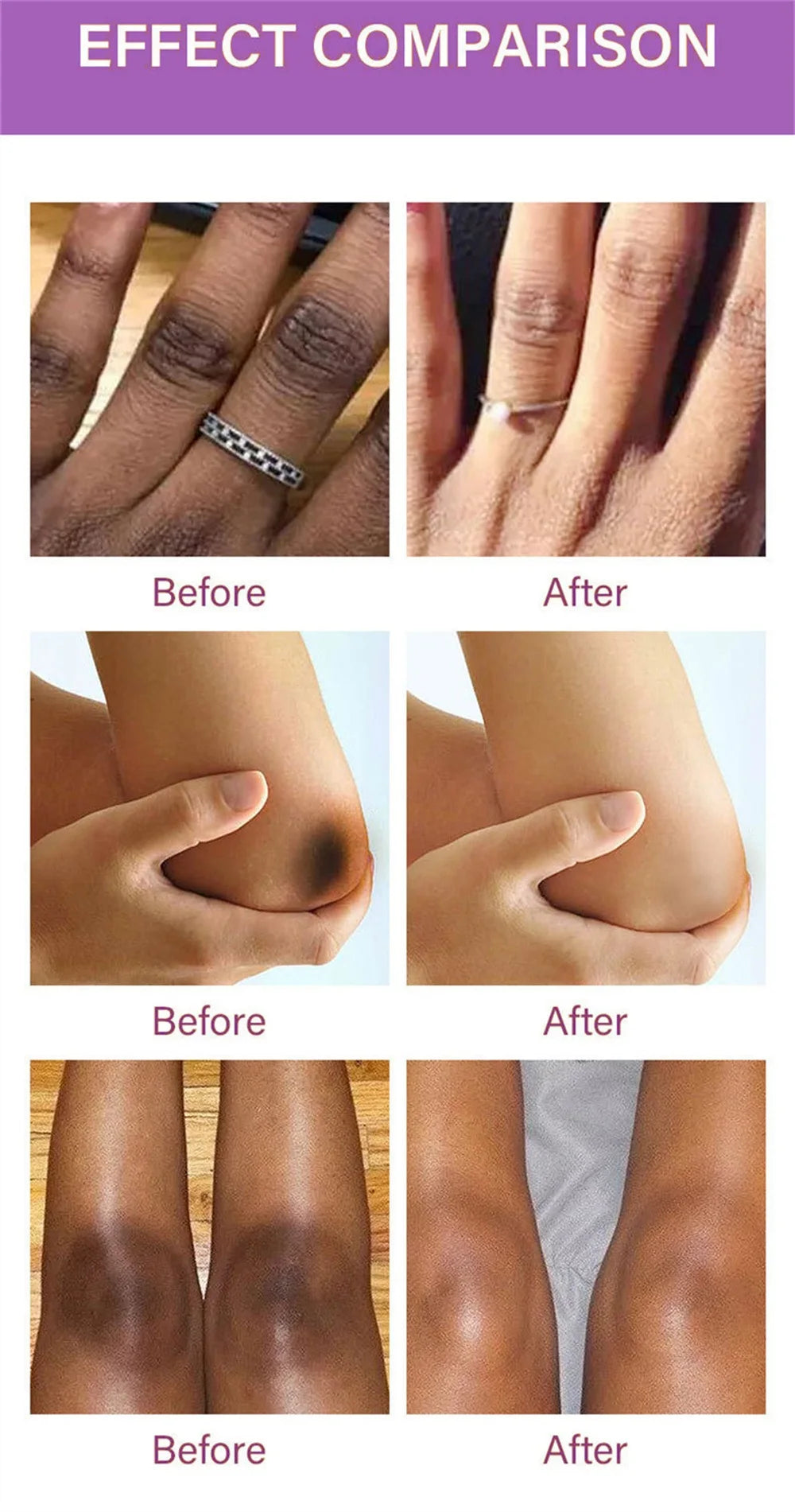 Body Whitening Cream Arms Thighs Underarm Knees Whitening Essence Cream Brighten Moisturizing Body Korean Skin Care Products New