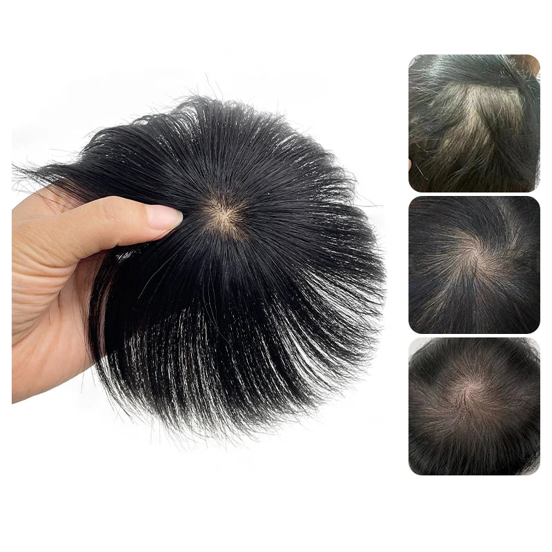 Mens Wig Human Hair Toupee Swiss Lace Pieces Wigs Natural Breathable Thinning Hair Cover-Up Forehead Balding Concealment
