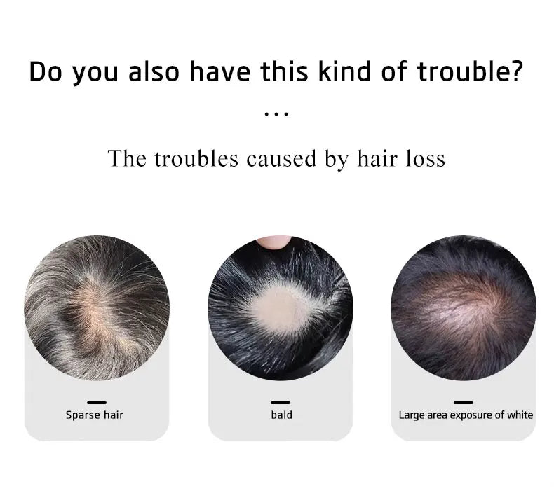 Mens Wig Human Hair Toupee Swiss Lace Pieces Wigs Natural Breathable Thinning Hair Cover-Up Forehead Balding Concealment