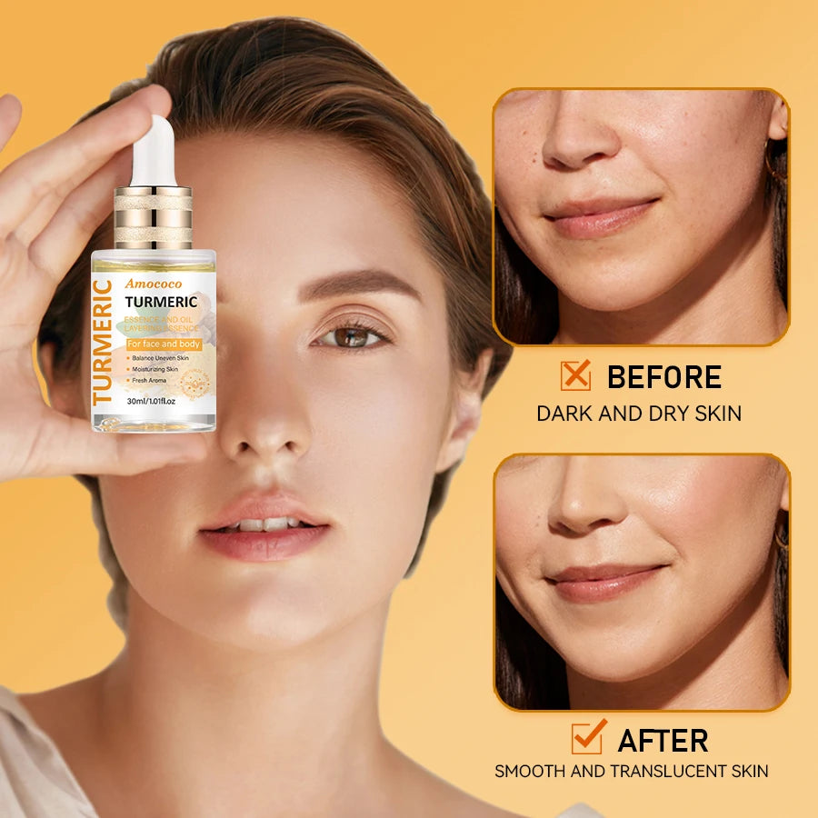 Amococo 2pcs Turmeric Niacinamide Serum Oil 30ml Water Oil Layered Essence for Face and Body Moisturizing Facial Serum with Vitamin C Hyaluronic Acid Turmeric Extract Niacinamide Lightweight Daily Skin Care