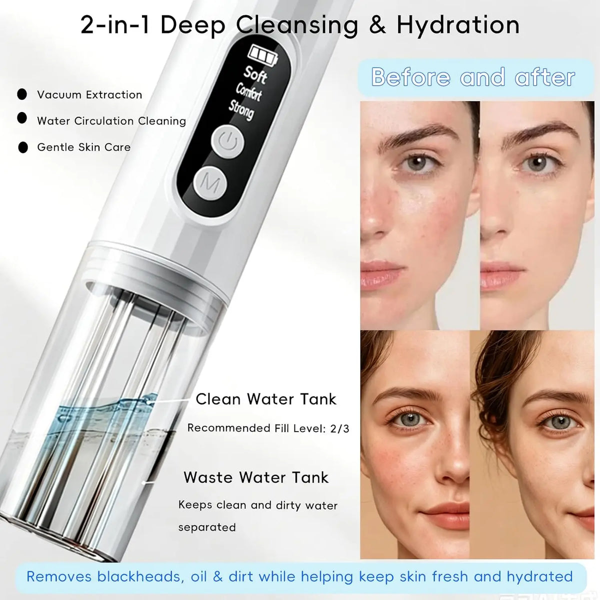 Pore Vacuum Blackhead Remover Portable Blackhead Extractor with 6 Suction Heads Electric Facial Cleansing Tool for Face & Nose
