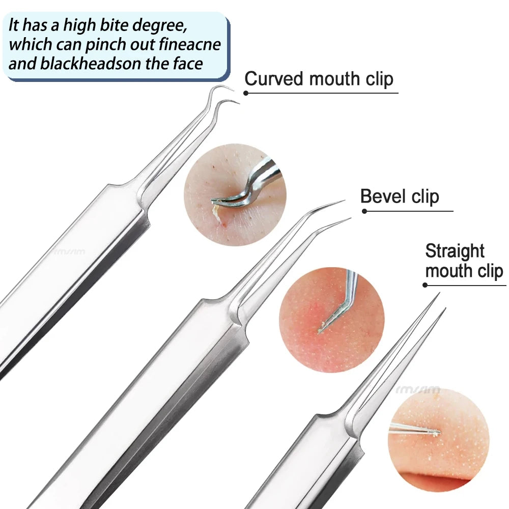 German Ultra-fine No. 5 Cell Pimples Blackhead Clip Tweezers Beauty Salon Special Facial Pore Cleaning Acne Wart Skin Care Tools