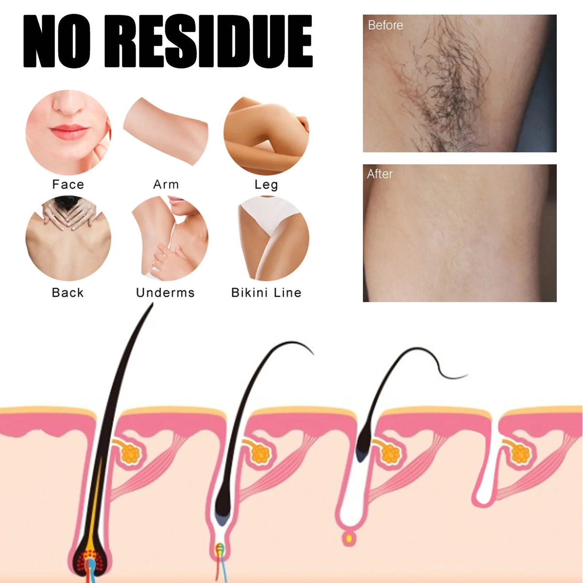 Permanent Hair Removal Cream Painless Intimate Parts Legs Body Armpit Depilatory For Man Women Whitening Body Care Products 30ml