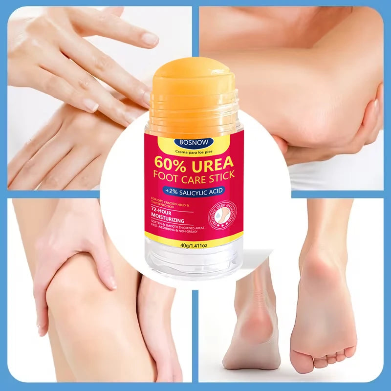 【Special for Dry and Cracked Skin】Hand and Foot Moisturizing Stick/Hand Cream/Cracked Foot Cream, 72-Hour Continuous Care for Extremely Dry Skin, Absorbs Quickly in 5 Minutes, Deeply Hydrates and Moisturizes, Softens Cuti