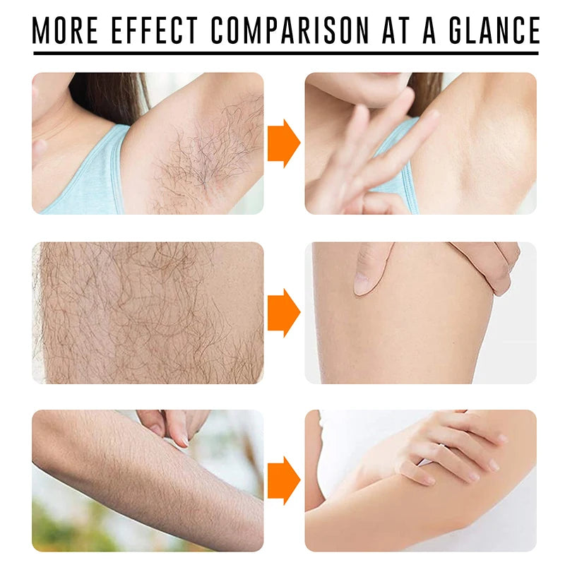 Permanent Hair Removal Cream Painless Intimate Parts Legs Body Armpit Depilatory For Man Women Whitening Body Care Products 30ml