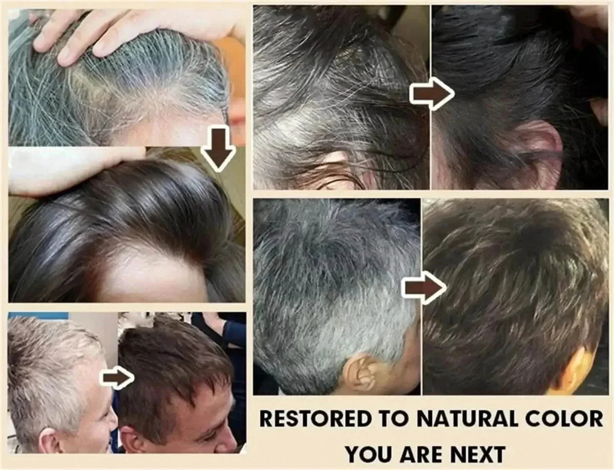 White To Black Gray White Hair Serum Natural Color Repair Nourishessence Anti-gray Care For Men Women *5&JI^