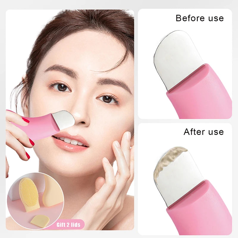 Blackhead Removal Tool, Acne Removal, Use with Mud Cream and Cleansing Oil, Facial Cleansing, Beauty Tools