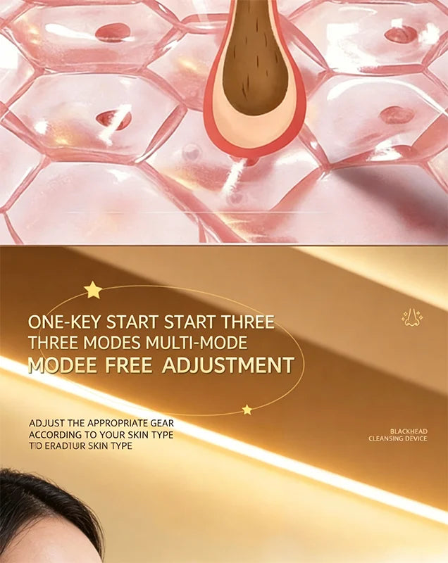 Blackhead Suction Device Electric Suction Beauty Salon Men's Specific Blackhead Suction Device