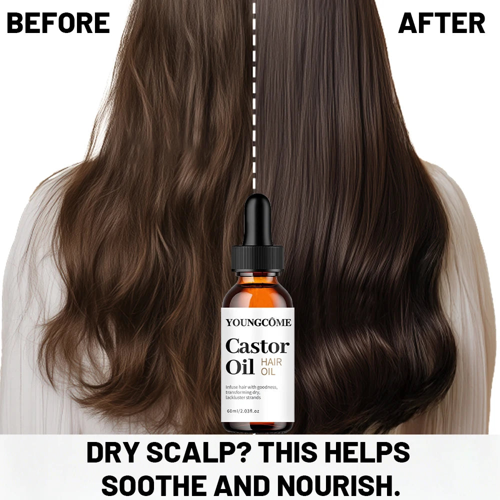 YOUNGCOME Castor Hair Oil Moisturizing Serum For Dry Damaged Hair Frizz Control Split Ends Care Shine Boosting Treatment