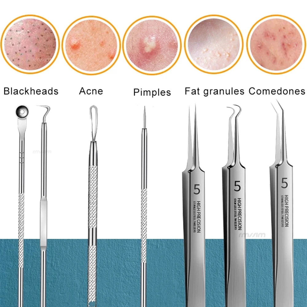 German Ultra-fine No. 5 Cell Pimples Blackhead Clip Tweezers Beauty Salon Special Facial Pore Cleaning Acne Wart Skin Care Tools