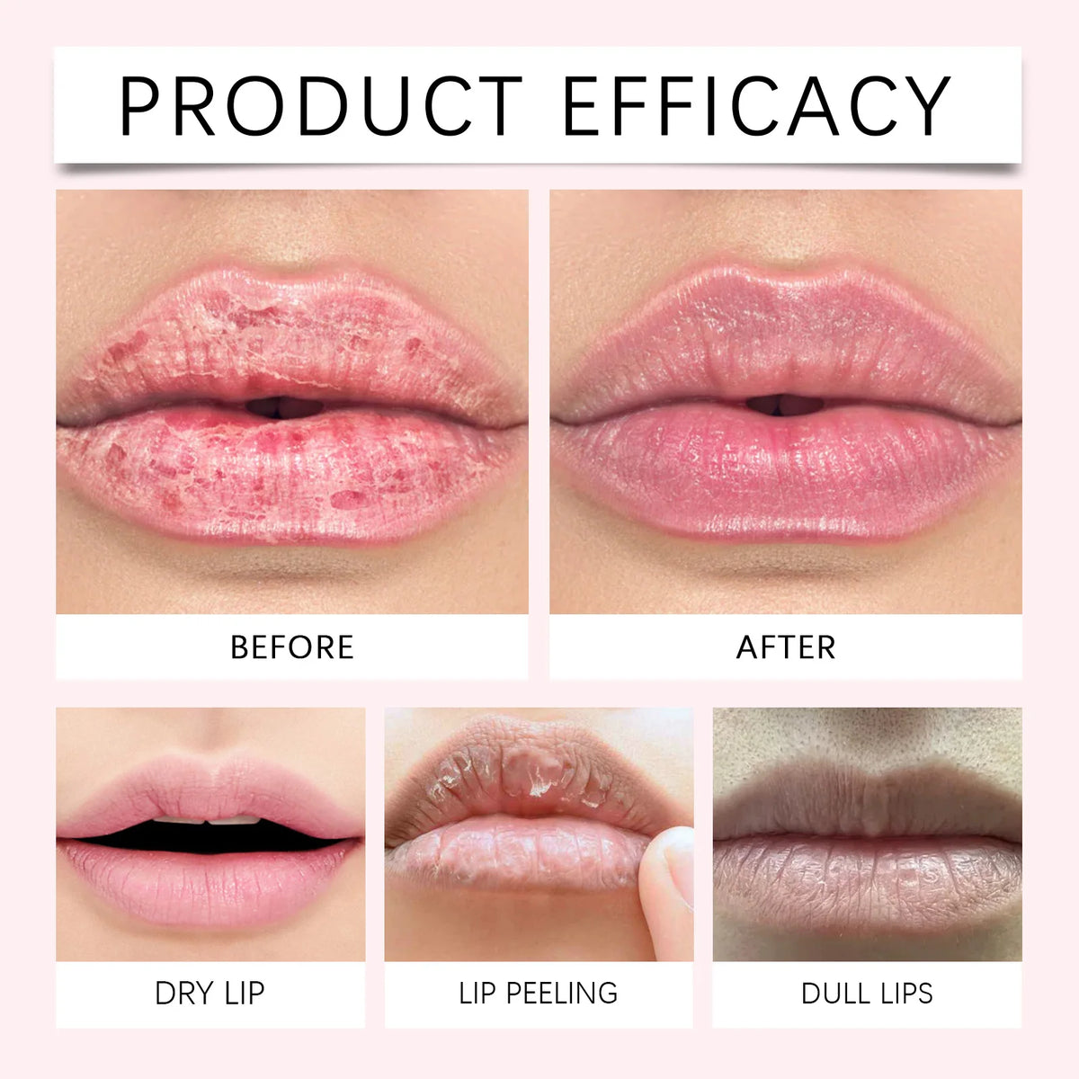Strawberry Mint Lip Exfoliator Sea Salt Scrub Gentle Polishing For Chapped Peeling Lips Smoothing Lip Prep Before Lipstick