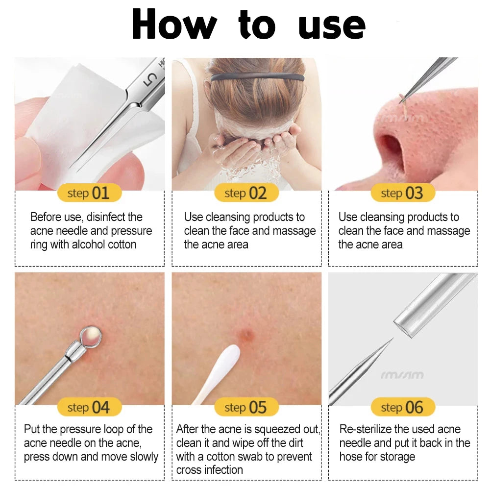 German Ultra-fine No. 5 Cell Pimples Blackhead Clip Tweezers Beauty Salon Special Facial Pore Cleaning Acne Wart Skin Care Tools