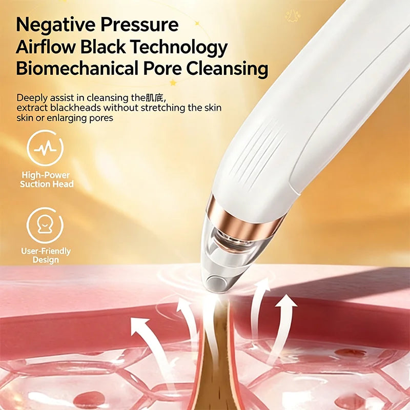 Blackhead Suction Device Electric Suction Beauty Salon Men's Specific Blackhead Suction Device