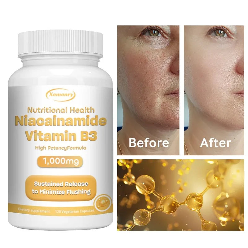 Niacinamide Vitamin B3 Capsules - Supports Brain Function and Heart Health, Boosts Energy Production, and Enhances Immunity