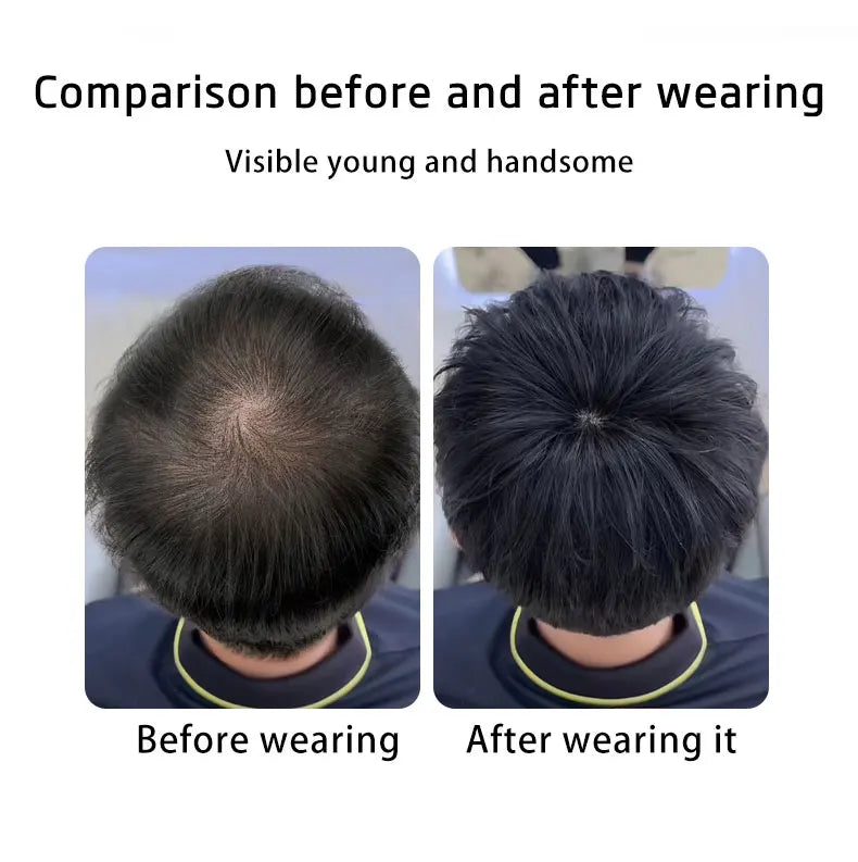 Mens Wig Human Hair Toupee Swiss Lace Pieces Wigs Natural Breathable Thinning Hair Cover-Up Forehead Balding Concealment