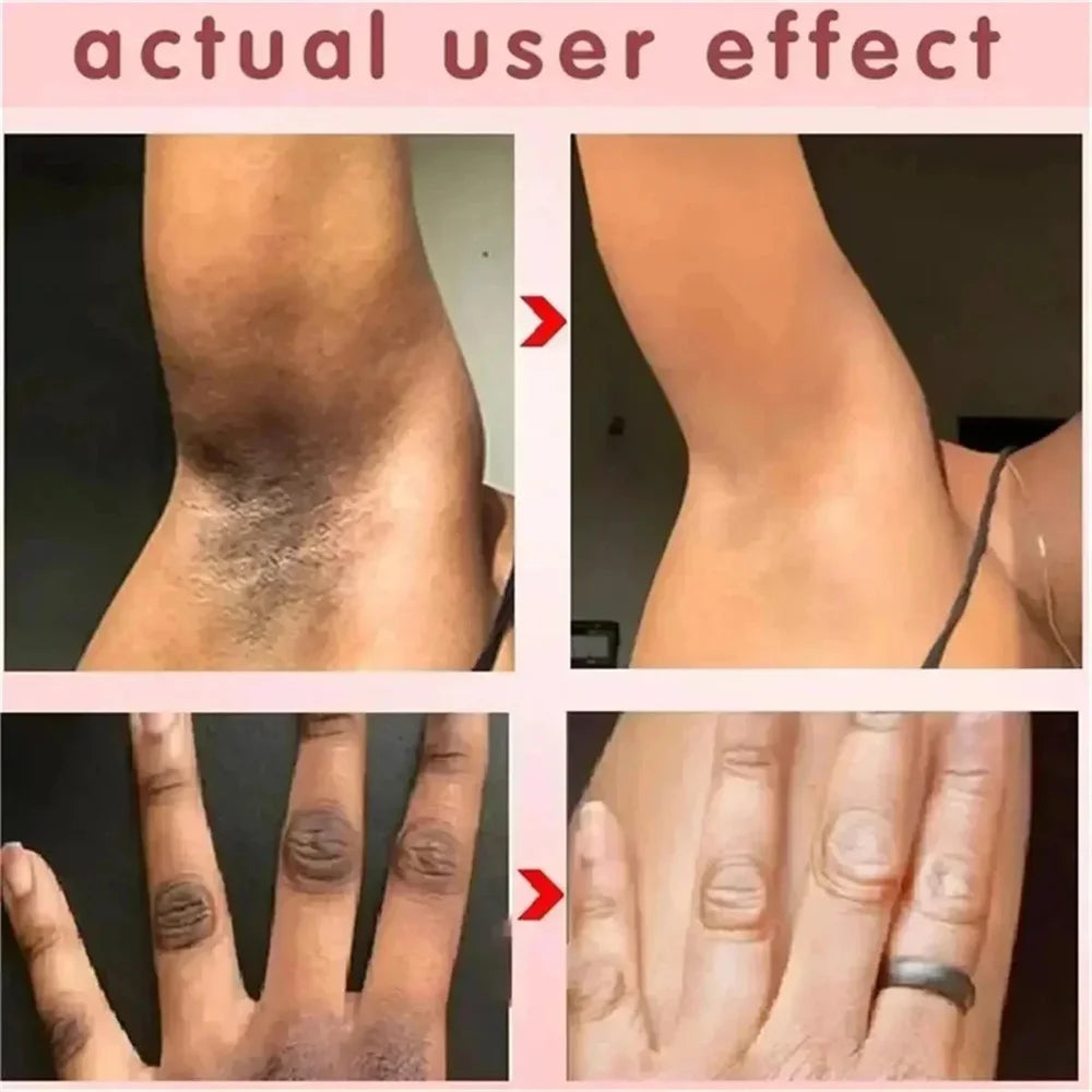 Body Whitening Cream Arms Thighs Underarm Knees Whitening Essence Cream Brighten Moisturizing Body Korean Skin Care Products New