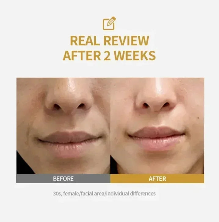 Deep Collagen Peptide Pink PDRN Ampoule Essence Intensive Brightening Moisturizing Firming Smooth Fine Lines Daily Facial Care