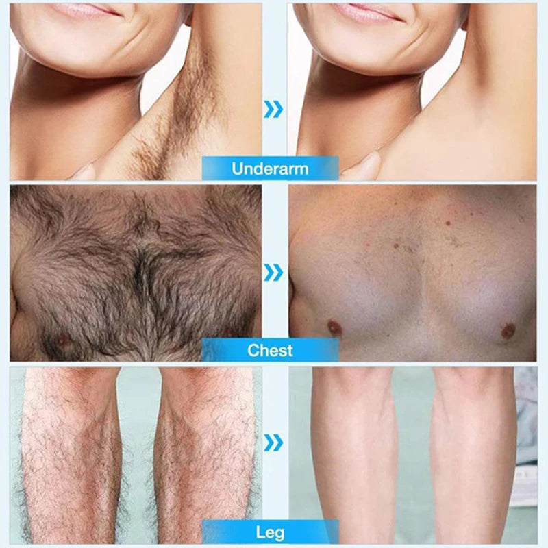 Permanent Hair Removal Cream Painless Intimate Parts Legs Body Armpit Depilatory For Man Women Whitening Body Care Products 30ml