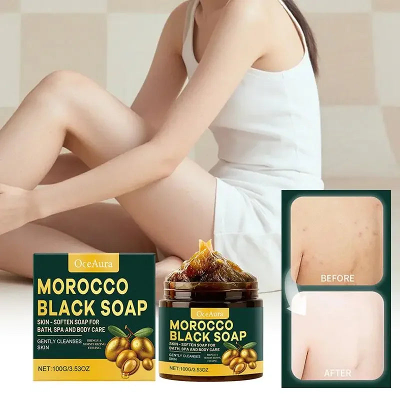 Moroccan Black Soap Deep Cleansing Gentle Care Moisturizing Body Soap with Olive & Argan Oil for Soft Smooth Skin 100g