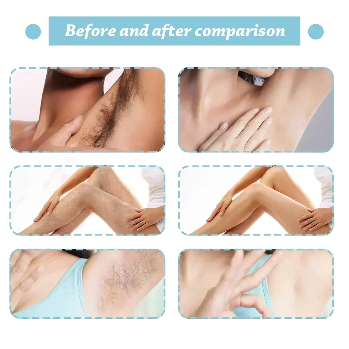 Hair Inhibition Serum Spray Painless Permanent Depilatory Cream Slow Hair Regrowth Full Body Private Parts Silky Skin Care