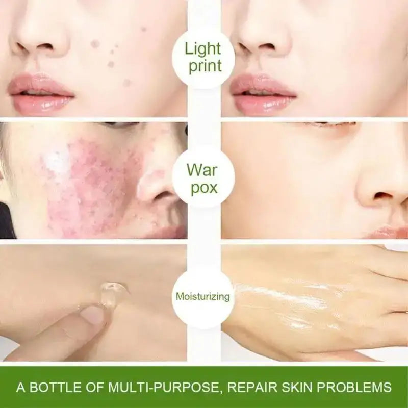 Natural 99% Aloe Vera Gel Moisturizing Soothing Sensitive Skin After Sun Repair Dilutes Acne Marks DIY Cream Lotion Mask Gel