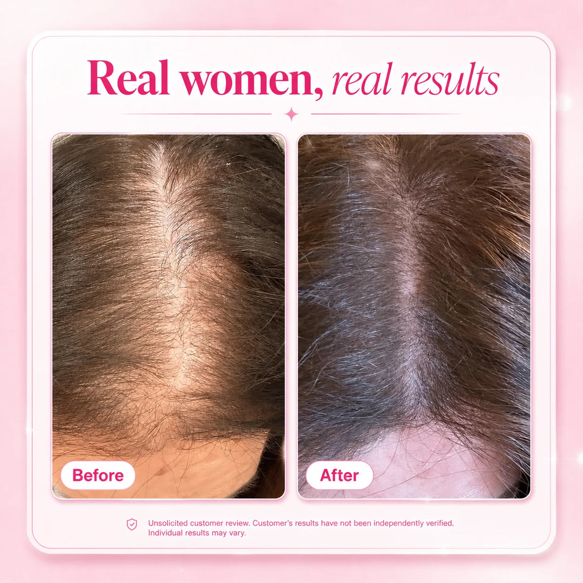 Hair Support Supplements for Women, Thicker Fuller-Looking Hair Beauty Support, with Biotin and Marine Collagen, 180 Tablets