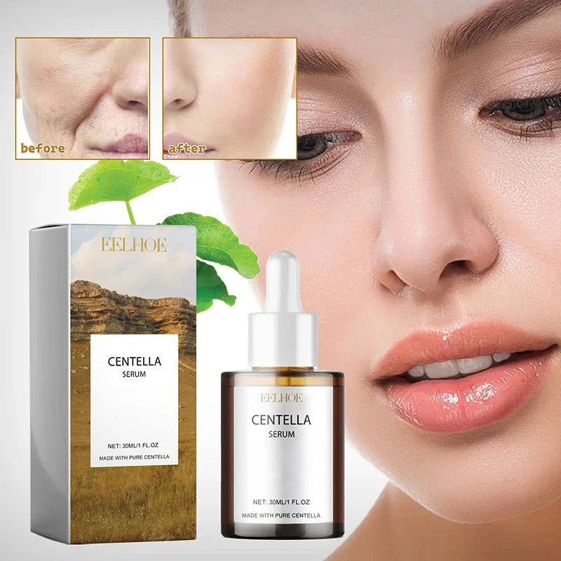 Centella Asiatica Face Serum Nourish Dry Skin Smoothing Rejuvenation Skin Brightening Whitening Cream Facial Moisturizer Korean