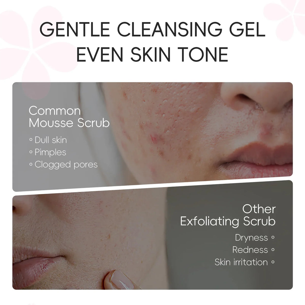 Laikou Japan Sakura Exfoliating Peeling Gel 60g, Gentle Face Body Scrub Deep Clean Remove Dead Skin Hydrating Smooth Skin Care