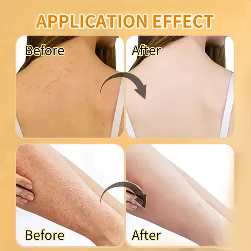 Amococo 2Pcs Turmeric Body Scrub Exfoliating Dead Skin Remover 280g Deep Cleansing Nourishing Smooth Skin