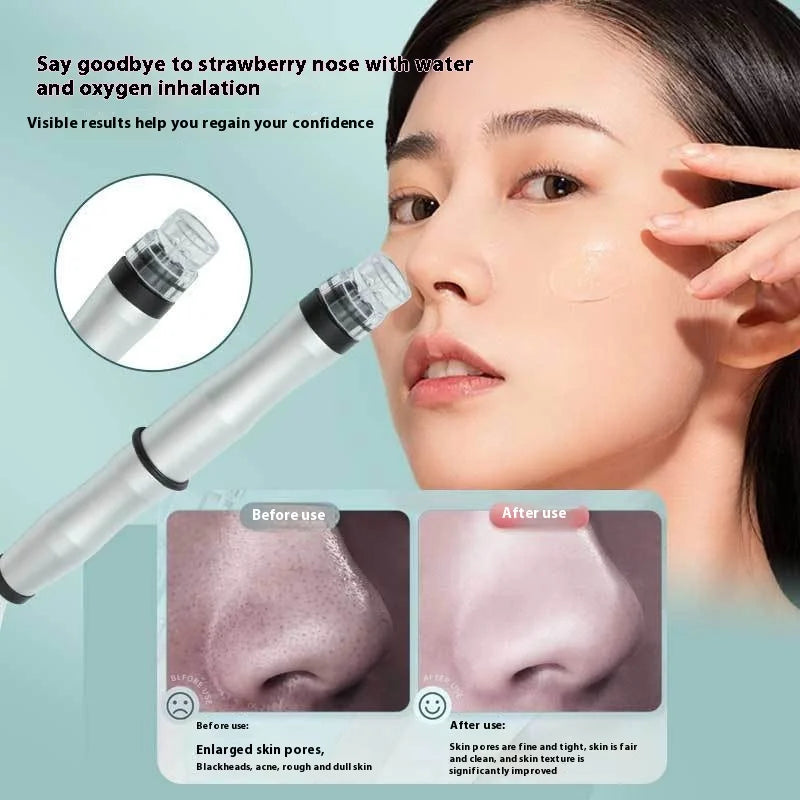 Blackhead Suction And Bubble Removal Beauty Device