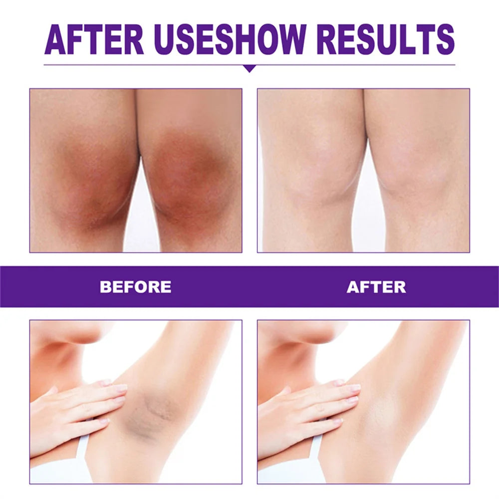 Body Whitening Cream Arms Thighs Underarm Knees Whitening Essence Cream Brighten Moisturizing Body Korean Skin Care Products New